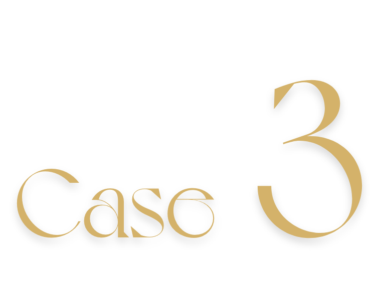 case3